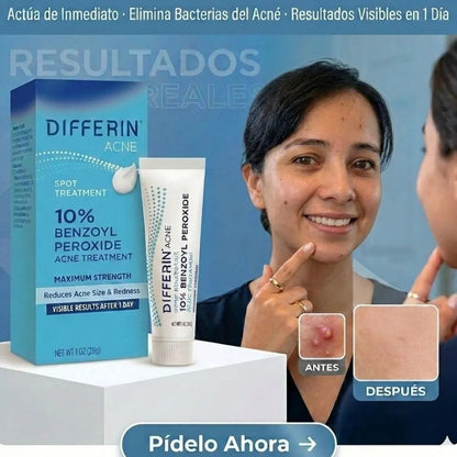 PREMIUN Antiacné: DIFFERIN MAX.Potencia
